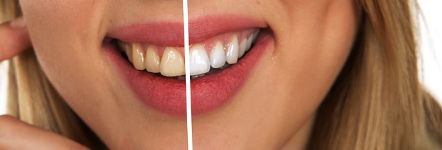 Přírodní prášek na bělení zubů s aktivním uhlím